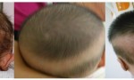 原创
            宝宝头发稀少，后脑勺没有头发是缺钙吗？