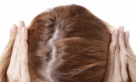 掉头发严重是什么原因女性？身体带来的这些变化你了解吗?